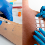 allergy-skin-test allergy-skin-test
